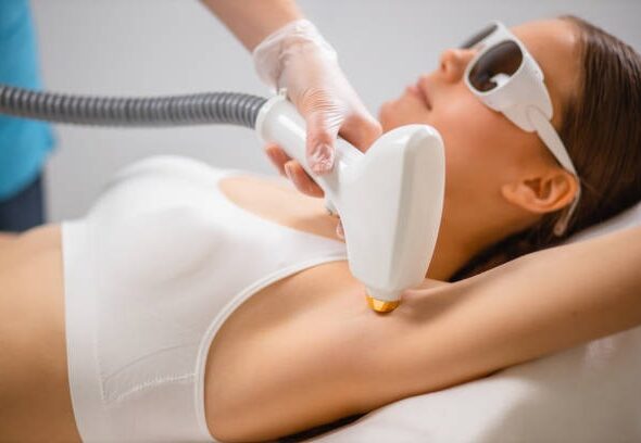 How to Plan a Cost-Effective Laser Hair Removal Journey