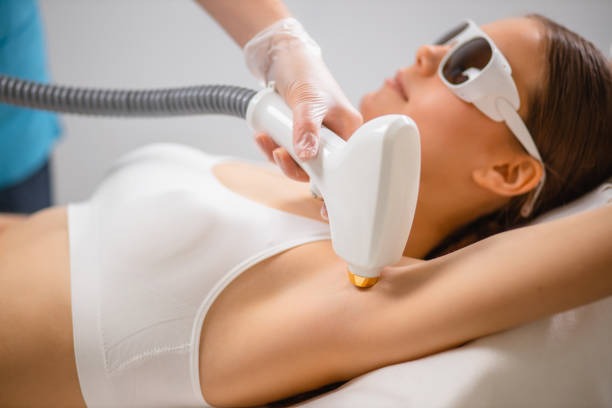 How to Plan a Cost-Effective Laser Hair Removal Journey
