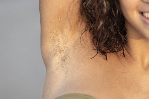 The Modern Approach to Long-Term Hair Reduction